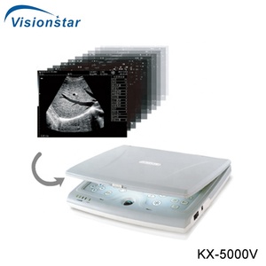 Ecógrafo Veterinario KX-5000, <span class=keywords><strong>Precio</strong></span> Económico, Máquina <span class=keywords><strong>de</strong></span> Ultrasonido Veterinario Portátil Completamente Digital - Product Image 3