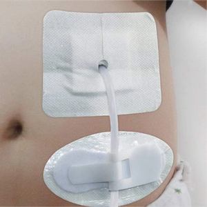 Pemegang tabung urin kateter Fixator antislip kolektor stabilisasi drainase canula fiksasi stiker kateter memperbaiki perangkat - Product Image 5