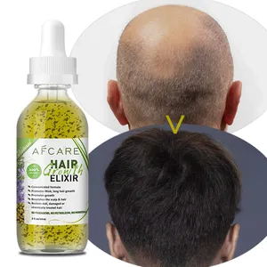 Top Haargroei Olie Fabrikant Parabenen-Vrije Anti-Roos Voedende En Tea Tree Castor Olie Vitamine E Olie Voor Haargroei