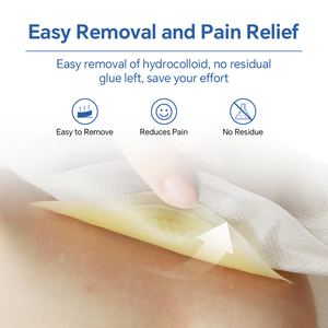 Tùy chỉnh giá rẻ giá một mảnh móc vòng lặp bằng chứng bị rò rỉ stoma chứa chất thải colostomy Túi hồng ngoại xa khử trùng CE chứng nhận cho - Product Image 5