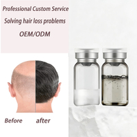Sérum capillaire pour la croissance des cheveux, marque blanche, Huile et Lotion de croissance pour femmes et hommes, Produits de repousse des cheveux