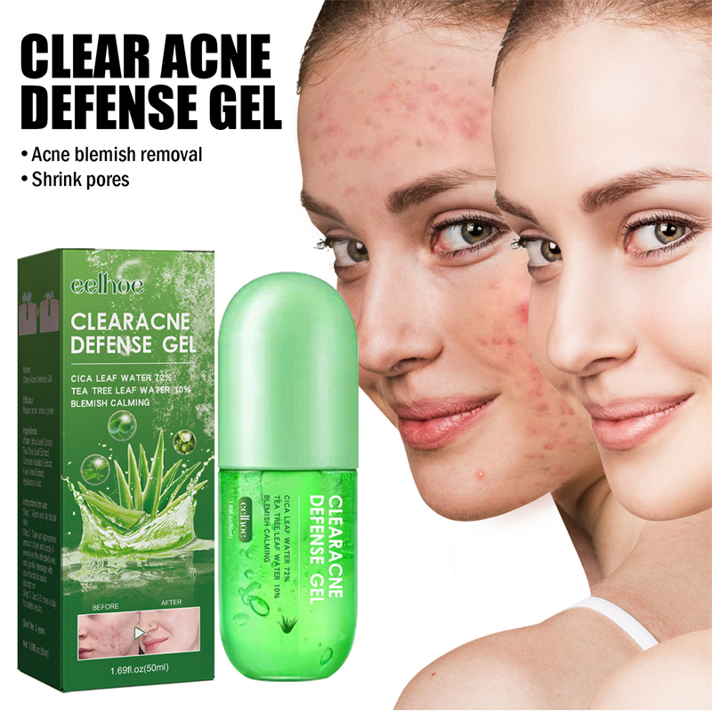 OEM clear Acne Defense Gel Wholesale Moisturizing Softening Acne Spots Removing Pores Shrinking Aloe Vera Gel Dropshipping
