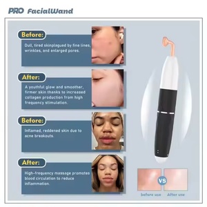7 in 1 Handheld Rechargeable Skin Rejuvenation High Frequency Facial Wand Beauty Device Wireless Use - Product Image 4