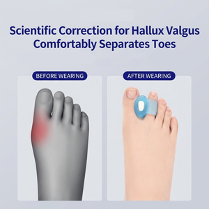 Entre-doigts en silicone pour <span class=keywords><strong>hallux</strong></span> <span class=keywords><strong>valgus</strong></span> – Correcteur et ajusteur pour soulager la douleur du bourgeon et prévenir l'empilage des orteils – Confort tout au long de la journée pour hommes et femmes - Product Image 4