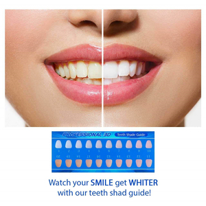 <span class=keywords><strong>Bandes</strong></span> <span class=keywords><strong>blanchissantes</strong></span> pour les <span class=keywords><strong>dents</strong></span> en marque privée avec ingrédient efficace pour un traitement de blanchiment dentaire à domicile - Product Image 6