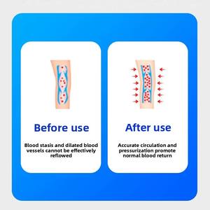 Bottes de thérapie par compression d'air portables pour les jambes enflées, soulagement de la douleur et amélioration de la circulation sanguine - Product Image 3