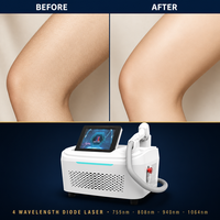 Appareil d'épilation au laser à diode, Épilateur laser, Épilateur laser professionnel, Épilation au laser à diode, Laser Diodo Fac