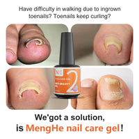 Menghe Kit de Pédicure pour Ongles Incarnés, Gel UV 3-en-1 Sans HEMA et Sans TPO, Vernis à Ongles Non Toxique 7ml 15ml, Gel Dur Anti-gravité