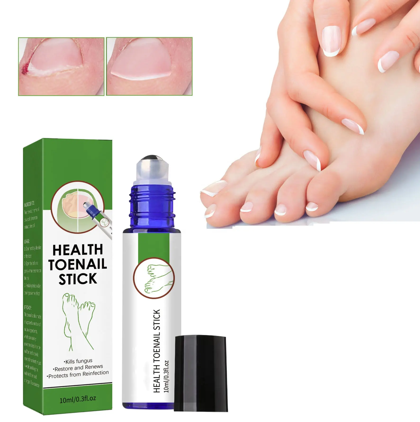 العلامة الصحية لأظافر القدم الأكثر مبيعًا لعلاج فطر الأظافر منتجات العناية وإصلاح الأظافر