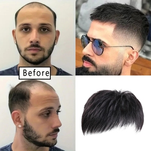 Tupé de Cabello Humano con Clip para Hombres con Cabello Fino, Estilo Empresarial Recto, Postizo Indetectable que Cubre Efectivamente el Cabello Gris - Product Image 2