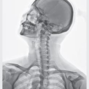 Imagerie sèche économique pour radiographie numérique, machine d'imagerie sèche à flux rapide, imprimante d'imagerie médicale thermique directe, série HQ-DY - Product Image 5