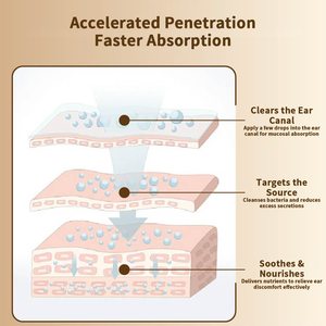 Soluzione <span class=keywords><strong>per</strong></span> la Cura delle Orecchie in Offerta, <span class=keywords><strong>Gocce</strong></span> Delicate Nutrienti, Pulizia Quotidiana Delicata, Vendita all'Ingrosso - Product Image 5