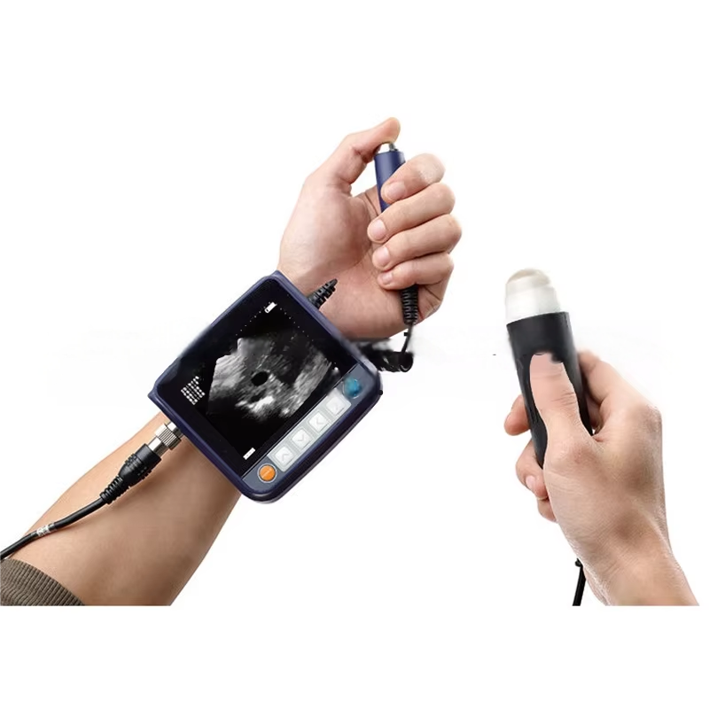 Fully Automatic Electric Intelligent Blood Pressure