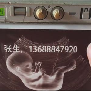 Medical High Glossy Thermal Carbon-Less Printing <b>Paper</b> Roll UPP-110HG Pure White Ultrasound <b>Paper</b> for Printer - Product Image 4