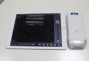 Mesin <span class=keywords><strong>Ultrasound</strong></span> Genggam Mini WiFi Nirkabel, Pemindai <span class=keywords><strong>Ultrasound</strong></span> B/M - Product Image 4