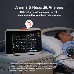 हैंडहेल्ड Co2 Spco2 पशु चिकित्सा उपकरण निगरानी उद्देश्यों के लिए महत्वपूर्ण हस्ताक्षर मल्टीपैरामीटर मॉनिटर - Product Image 3