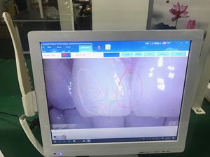 Unità Completa di Poltrona Odontoiatrica Modello CAD/<span class=keywords><strong>CAM</strong></span> Prezzo Competitivo - Product Image 5
