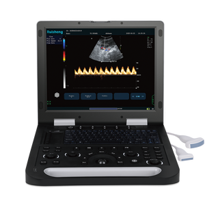 RS-CU5 Doppler warna 3D dokter hewan resolusi tinggi 15 inci hitam portabel PW CW gema Digital penuh ginekologi Ultrasound - Product Image 1