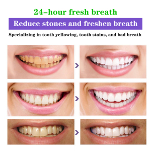 <span class=keywords><strong>Pasta</strong></span> <span class=keywords><strong>Dental</strong></span> <span class=keywords><strong>Desensibilizante</strong></span> con Logotipo Personalizado OEM/ODM DR DAVEY, Reduce las Incrustaciones y Refresca el Aliento - Product Image 5