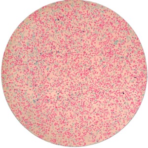 TCT Cervical Cytology Test Kit Papanicolaou Stain Solution Cell Sample Adult Medical Diagnostic Use - Product Image 2