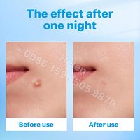 Patchs anti-acné hydrocolloïdes personnalisés en forme d'étoiles jaunes mignonnes (24 pièces) pour le traitement des boutons – Marque privée