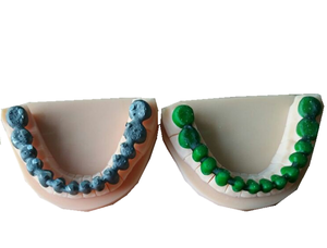 Resina Dental de Alta Calidad para Coronas Temporales y Marcos para Impresora 3D DLP/LCD - Product Image 5