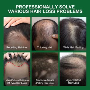 Chất Lượng Cao Cấp decolor Tăng Trưởng Tóc Dầu Thảo Dược Hữu Cơ Thuần Chay Công Thức Hương Thảo Tinh Huyết Thanh Tự Nhiên Cho Tóc Bị Hư Hỏng - Product Image 5