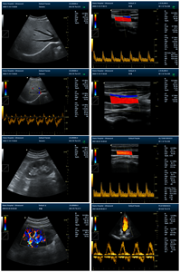 15 Inch Professionele Cardiale Kleur Doppler Tdi Echografie Ziekenhuis Cardioloog Echografie - Product Image 5