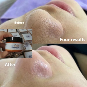 Salon de beauté Crème de purification des follicules pileux Nettoyage des pores Points noirs Élimination de l'acné Dérivée de la crème de massage nettoyante fermée - Product Image 4