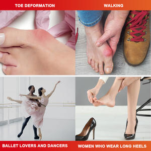 Oem Yüksek Kaliteli Vegan İçerikli Enfeksiyon Bakımı Ağrı Giderici Bunyon Rahatlatıcı Ayak Ağrısı Sertlik Bunyon Kremi - Product Image 6