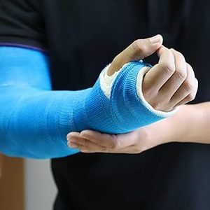 شريط جبس من الألياف الزجاجية لتثبيت الكسور ودعم العظام - Product Image 4