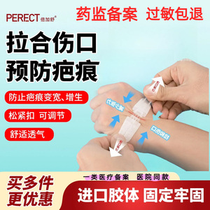 Dispositivo de sutura para heridas cutáneas Beijiashu, vendaje elástico tipo cremallera para reducción de cicatrices y cuidado de heridas - Product Image 4