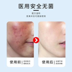 เว่ยไท่ เมดิคอล รีคอมไบน์ดิ้น ไทป์ 3 คอลลาเจน ดรสซิ่ง 20 มล. สำหรับซ่อมแซมบาดแผลและดูแลผิว - Product Image 4