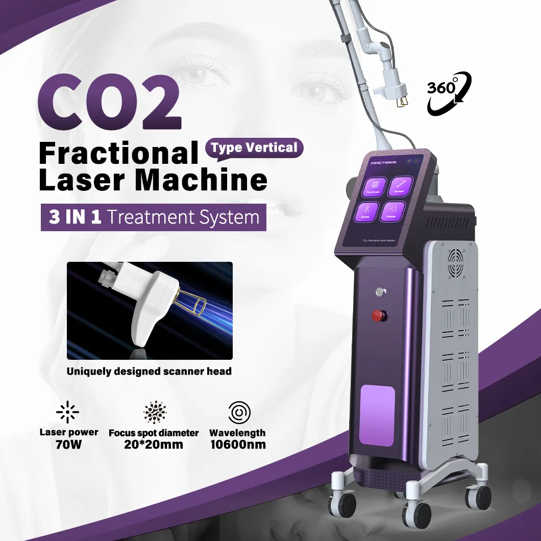 Fornecedor profissional de máquina de beleza a laser CO2 fracionária OEM 100W 10600nm para recapeamento da pele Tubo RF Máquina a laser fracionária CO2