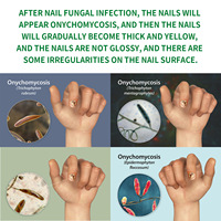 Soin des cuticules au gingembre 30 ml, sérum réparateur des ongles en 7 jours, solution antifongique pour les ongles abîmés des pieds, huile nourrissante