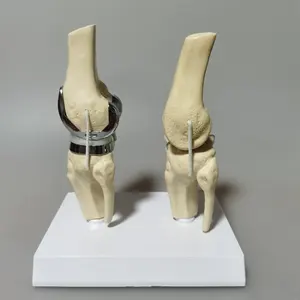Conjunto de modelo de implante de articulação de joelho artificial destacável para prótese de joelho KyrenMed