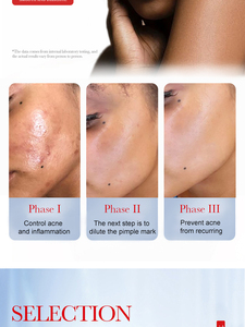 Phisya OEM mụn trứng cá loại bỏ Huyết thanh chống lão hóa Hydra ẩm Niacinamide salicylic axit mụn trứng cá chăm sóc da huyết thanh cho việc giảm lỗ chân lông mở - Product Image 6