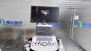 Ecógrafo Doppler Color Mindray Consona N5S con Elastografía y Auto IMT para Diagnóstico Multiespecializado - Product Image 6