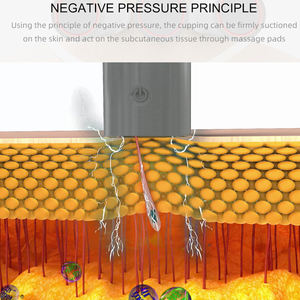 2025 nuovissima macchina per coppettazione elettrica ricaricabile con Display a LED intelligente corpo umano Gua Sha terapia massaggiatore per coppettazione sottovuoto - Product Image 5