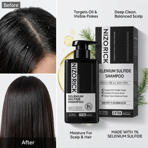 Champú Anticaspa con 1% de Sulfuro de Selenio de Marca Privada OEM, Tratamiento para la <span class=keywords><strong>Dermatitis</strong></span> Seborreica, Picazón y Cuero Cabelludo Graso - Product Image 1