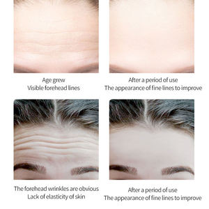 Forehead Sticker Cheek Chin <strong>Paste</strong> Anti <strong>Wrinkle</strong> Remover Face Lift Tape Stickers Face Lift Tape - Product Image 5