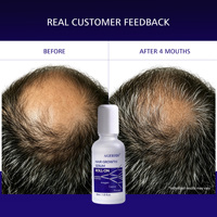 Sérum de croissance capillaire roll-on Redensyl Anagain pour des cheveux plus épais, formule légère à base d'eau, bloqueur de DHT, soutien du microbiome du cuir chevelu