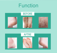 Masque exfoliant hydratant pour les pieds, chaussettes masque nourrissantes pour les pieds secs et gercés, soin de la peau, vente en gros