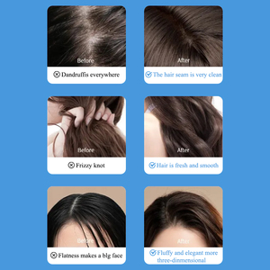 Shampoo au cuivre <span class=keywords><strong>bleu</strong></span> de haute qualité en gros pour la croissance des cheveux et les cheveux clairsemés, lissant, antipelliculaire - Product Image 3