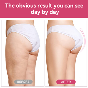 Chinaherb di alta qualità BBL vitamine a base vegetale dei glutei dell'anca Booster di ingrandimento Gummies per adulti donne - Product Image 4