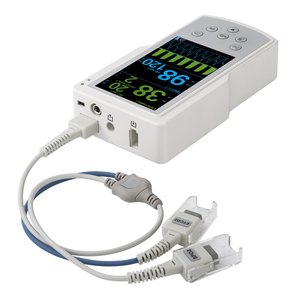 Veterinary Handheld Multiparameter Monitor with ETCO2 SPO2 - Product Image 3