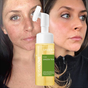 Aloe Vera ácido hialurónico vitamina E limpieza Mousse hidratante suave desmaquillador espuma limpiadora limpiador Facial - Product Image 5