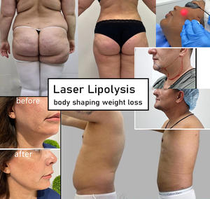 Machine de liposuccion Vaser Laser à diode à double onde 980nm1470nm Lipolyse raffermissant la peau Endolaser Lifting du visage - Product Image 5