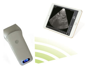 Mesin <span class=keywords><strong>Ultrasound</strong></span> Genggam Mini WiFi Nirkabel, Pemindai <span class=keywords><strong>Ultrasound</strong></span> B/M - Product Image 5