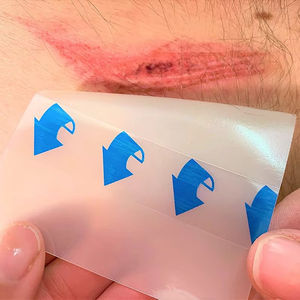 Apósito Médico Estéril de Hidrocoloide para Heridas, Uso Hospitalario, 5x5cm, Esterilizado con Óxido de Etileno, Clase II - Product Image 4